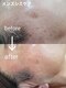 メルシー レディースアンドメンズサロン(Merci)の写真/メンズメニュー充実サロン　脱毛/フェイシャル/ボディマッサージOKです。
