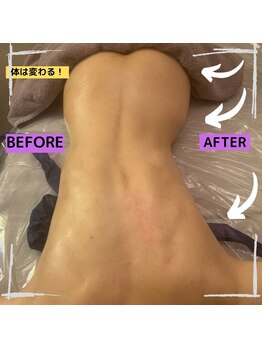 サロン ド カシェット 銀座/細くてもこんなに変わる[リンパ]