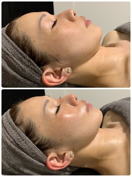 ラグ(LUXU)/リフトアップピーリング♪