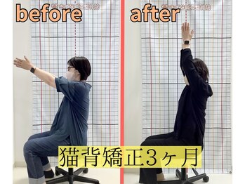 きずな鍼灸整骨院 武蔵ヶ丘本院/猫背矯正