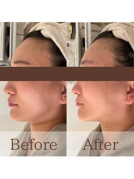 凪眠/小顔リンパフェイシャルの効果53