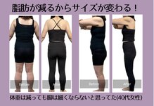 アネモネ