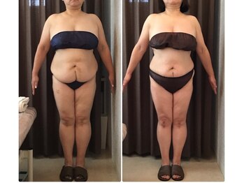美容整体 ウェリナ 蟹江院/.【ダイエットbefore→after】