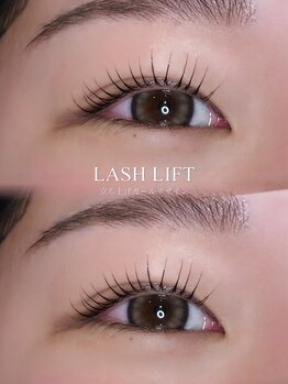 ジッピー オブ トータルビューティー アイエク(Zippy of totalbeauty iEQ)/