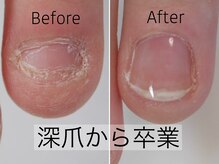 ネイルエニー(Nail Any)