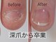 ネイルエニー(Nail Any)の写真