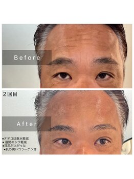 サロン ルイス アディクト(salon Lewis Addict)/イケオジ。シワがない方がモテる