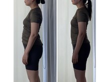 モモ(MoMo)の雰囲気（反り腰が改善されていくとウエストや下腹のサイズが変わります）