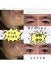 男女OK【長寿遺伝子美容液】集大成パック3部構成/結果重視エステ33000→22000