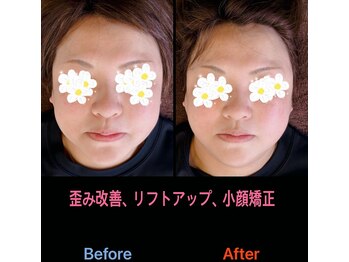 美容矯正サロン レレポノ(LELEPONO)/