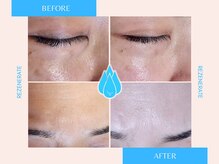 祥 新宿店(SYO)/最新美容液導入でシミシワレス♪