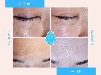 祥 新宿店(SYO)/最新美容液導入でシミシワレス♪