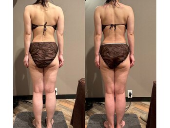 モモリラ(momorila)/活性リンパ洗浄