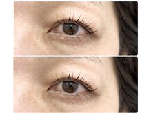 ティピ(tipi)/ラッシュリフト