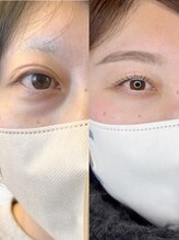 グロウビューティー(grow beauty)/