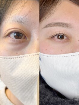 グロウビューティー(grow beauty)/