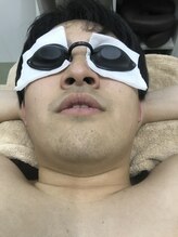 ナノハナ/鹿沼市本格全身脱毛ナノハナ