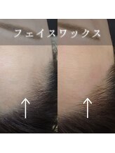 ビューティサロン ソル(Sol)/フェイシャルワックス