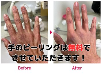 ラディアント たまプラーザ/手のピーリングは無料です！