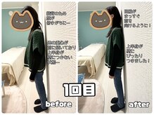シャイン(Shine)の雰囲気（猫背だったお客様の姿勢矯正1回目のBefore/Afterです！）