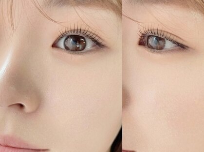 イエン(yien)の写真