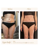 パチュプチ(Patchou petit)/before→after／痩身