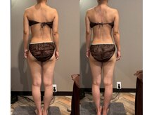 モモリラ(momorila)/活性リンパ洗浄