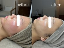 コム(comme39)/クリスティーナ×よもぎ蒸し