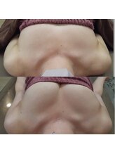 ロココ 錦糸町店(Rococo)/比較写真