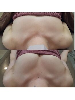 ロココ 錦糸町店(Rococo)/比較写真