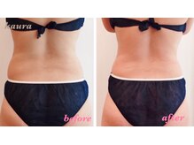 カウラ(Kaura)の雰囲気（１回で実感！結果重視の痩身サロン。短期集中ダイエットにも◎）