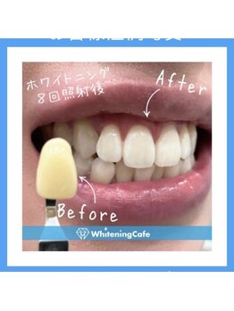 ホワイトニングカフェ 和歌山ガーデンパーク店(WhiteningCafe)/16分×2回照射/4回来店