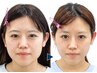頭も視界もクリアに!頭から整えパッチリ目&小顔♪【小顔矯正+頭蓋骨矯正】