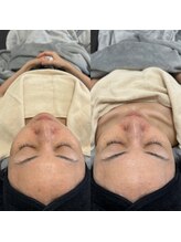 ルーラ(diva' LurA)/フェイシャル