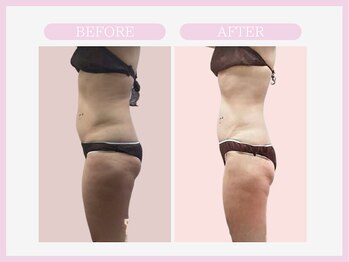 スリムライン 山形店(The Slim Line)/before→after