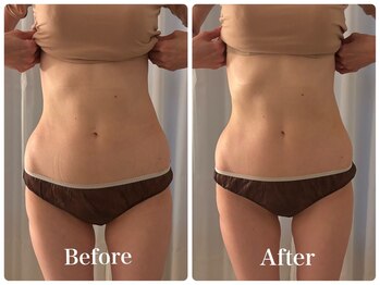 リリー 中目黒(Lily)/【Before→After】60分施術