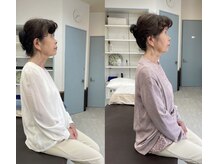 ラクナル 福岡市東区店(Laknal)/ストレートネック矯正・姿勢改善