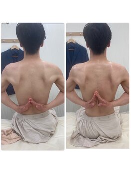 ソルニス(Solnis.)/痩身☆脂肪分解/ハイパーナイフ