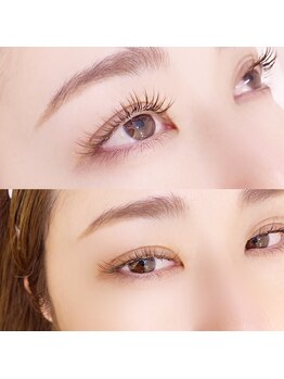 イーエヌトリップ(en.trip)/バインドロック80束