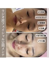 ファミリータイズカンパニーガデス(Family Ties Co. Goddess)/【韓国機器】小顔フェイシャル