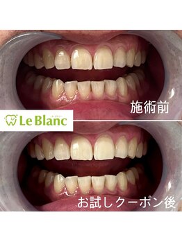 ルブラン 奈良店(Le Blanc)/新生活に向けて!