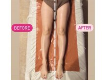 アディクト(Addict)/脚ダイエット