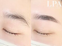 レピア 仙台店/韓国式LEPIA Before&Aｆter