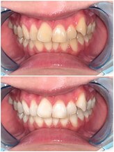 ライトビューティー 池袋店(LightBeauty)/症例写真