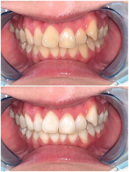 ライトビューティー 池袋店(LightBeauty)/症例写真