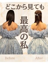 クレール整体院/【二の腕】印象に激変★