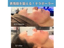 癒える(ielu)の雰囲気(SNSで話題!顔ぎゅん体験でたるみケア&美肌を同時に★)