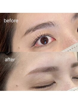 ビオラス(Biolus)/【眉毛/まゆげ】Before/After