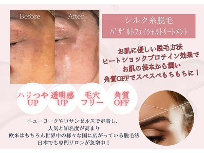 アジャストメント ナチュラル(adjustment natural)の写真