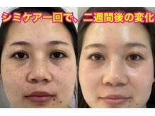 東洋経絡エステ アンド リラクゼーション